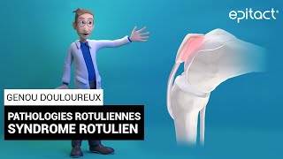 Syndrome Rotulien  Explication  EPITACT [upl. by Mick959]