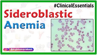 Sideroblastic Anemia  Causes Pathogenesis Clinical Presentation Diagnosis Treatment [upl. by Ayotac]