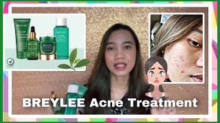 Honest Review BREYLEE Acne Treatment Perawatan Wajah Berjerawat [upl. by Yuh]