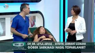 Göbek sarkması nasıl toparlanırOp Dr Leyla Arvas [upl. by Elocon363]