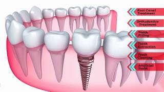 Doctor Aklilu Specialty Dental Clinic [upl. by Oikim386]