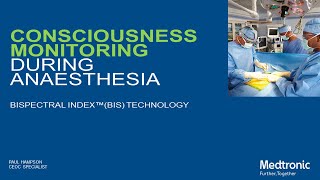 Consciousness Monitoring During Anaesthesia BIS Technology [upl. by Shorter]