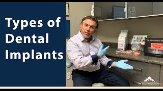 Types of Dental Implants [upl. by Hamann]