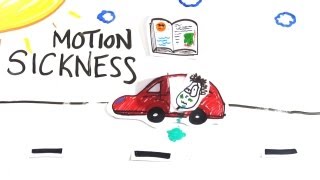 Motion Sickness  What is it [upl. by Heinrike]