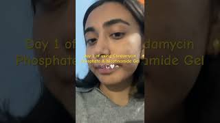 Using Clindamycin Phosphate amp Nicotinamide Gel girls skincare acne [upl. by Arytas]