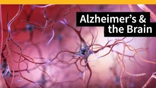 How Alzheimers Changes the Brain [upl. by Donny]