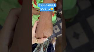 Cannulation in difficult veins  Finding difficult veins  cannulation [upl. by Varick]