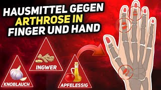 7 Natürliche Hausmittel gegen Arthrose in Finger und Hand [upl. by Hsiwhem958]