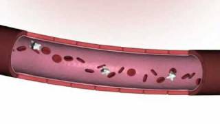 Modulación de la Inflamación con Fibroquel [upl. by Norse129]