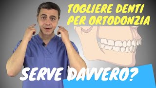 SANIDENT  Carie profonda e devitalizzazione del dente [upl. by Iny711]