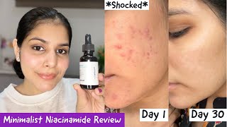 How I Cleared My Acne Within 30 Days  Minimalist 10 Niacinamide  Zinc Review [upl. by Idnas]