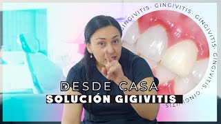 Gingivitis Tratamiento casero  Causas y soluciones [upl. by Henn912]