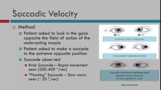 Saccadic Velocity [upl. by Dodie]