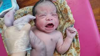 Breech Delivery birth of Big Chubby newborn baby Girl girl cute viral cute [upl. by Dobson]