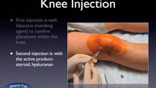 Knee injection web [upl. by Nwatna]