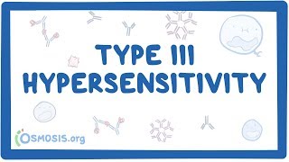 Type III hypersensitivity immune complex mediated  causes symptoms amp pathology [upl. by Luhar]