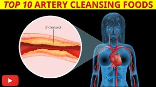 ►Top 10 Artery Cleansing Foods Clinically Proven  by Dr Sam Robbins [upl. by Barret]