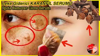 Miracle Clove Face Serum Put Clove and Lemon Peel Into Tea Bags Eliminate Spots in 30 Minutes [upl. by Nelac]