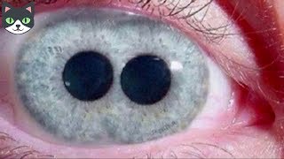 5 INCREÍBLES OJOS HUMANOS QUE NO CREERÁS QUE EXISTEN  OJOS UNICOS EN EL MUNDO [upl. by Newcomb186]