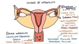 Understanding Infertility Causes and Investigations [upl. by O'Neill]