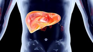 Mayo Clinic Minute When colon cancer spreads to the liver [upl. by Adriaens]