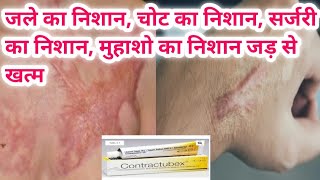 contractubex gel का use चोट निशान जले का निशान ओर किसी भी प्रकार के निशान को जड़ से खत्म [upl. by Ohcamac960]