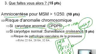 Dossier PAE  Gynéco Obstétrique 03 [upl. by Atnoed493]