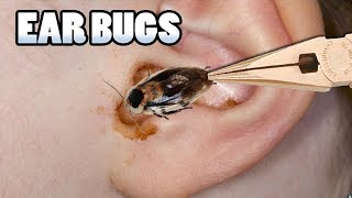 Most Popular Bugs in Ears Bug Removal amp Prevention [upl. by Pihc340]