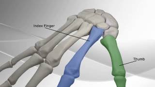 Thumb Metacarpal Arthritis Repair with Arthrex® CMC Mini TightRope® [upl. by Sitoeht]