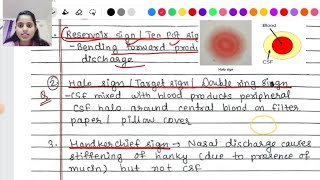 CSF rhinorrhea  causes symptoms Signs diagnosis treatment [upl. by Gredel]