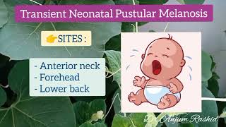 Newborn Baby Rash  Part 2  Transient Neonatal Pustular Melanosis Cause Symptoms amp Treatment [upl. by Novah]