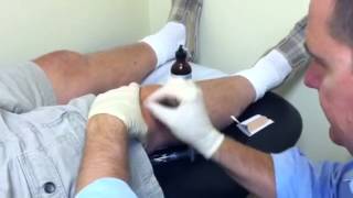 Sports Medicine South Carolina  Synvisc One Injection [upl. by Beedon]