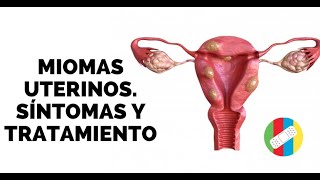 MIOMAS UTERINOS Síntomas y Tratamiento [upl. by Adnahsar847]