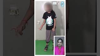 Cerebral palsyaffected girl with crouch gait started walking independently at Trishla CPchild [upl. by Eissak]