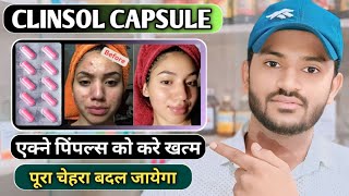 Clinsol capsule uses in hindi how to take clinsol capsule full review in hindi [upl. by Emery57]