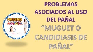 Caracteristicas del Muguet o Candidiasis de pañal  Higiene salud infantil  puericultura [upl. by Bough296]