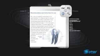 VDW Dental · How To Mtwo  Root canal preparation [upl. by Mak]