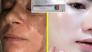 Salicylic acid cream  Remove Pigmentation  Dark spot  Acne amp Acne scars  Brijwasi Girl  India [upl. by Pestana]