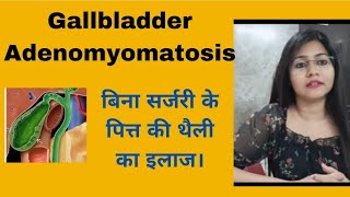 Gallbladder Adenomyomatosis symptoms amp homeopathic medicine बिना सर्जरी के पित्त की थैली का इलाज [upl. by Airliah752]