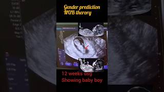 12weeks Ultrasound of baby boygender prediction nub theory shortsfeed reels [upl. by Comyns]