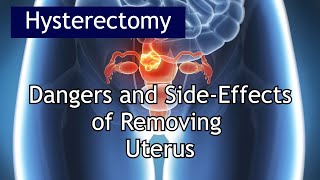 Hysterectomy Dangers amp Side Effects  Antai Hospital [upl. by Desireah]