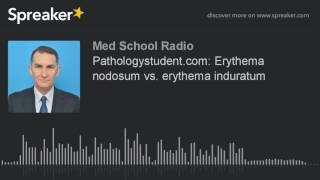 Pathologystudentcom Erythema nodosum vs erythema induratum made with Spreaker [upl. by Ariaec]