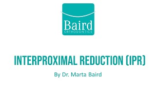 Interproximal Reduction IPR at Baird Orthodontics [upl. by Benedix300]