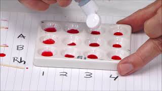 Blood Typing Activity [upl. by Elburr]