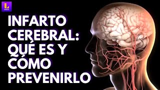 Infarto cerebral síntomas secuelas y todo lo que debes saber [upl. by Joappa]