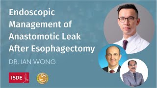 Endoscopic Management of Anastomotic Leak After Esophagectomy  Dr Ian Wong [upl. by Batory]