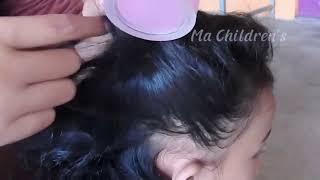 ASMR Lice and Nits Removal for Ultimate Scalp Check  Satisfying [upl. by Cassady]