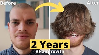 💇🏻💈Hair Growth Time Lapse 2 Years 24 Months Men  From Buzz Cut [upl. by Yessac]