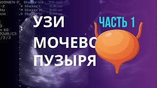 УЗИ анатомия мочевого пузыряТолщина стенки связки урахус и другие особенности УЗИ мочевого пузыря [upl. by Suk139]