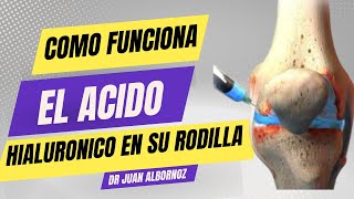 QUÉ HACE EL ÁCIDO HIALURÓNICO EN SU RODILLA doctorjuancarlosalbornoz artrosisderodilla [upl. by Leba563]